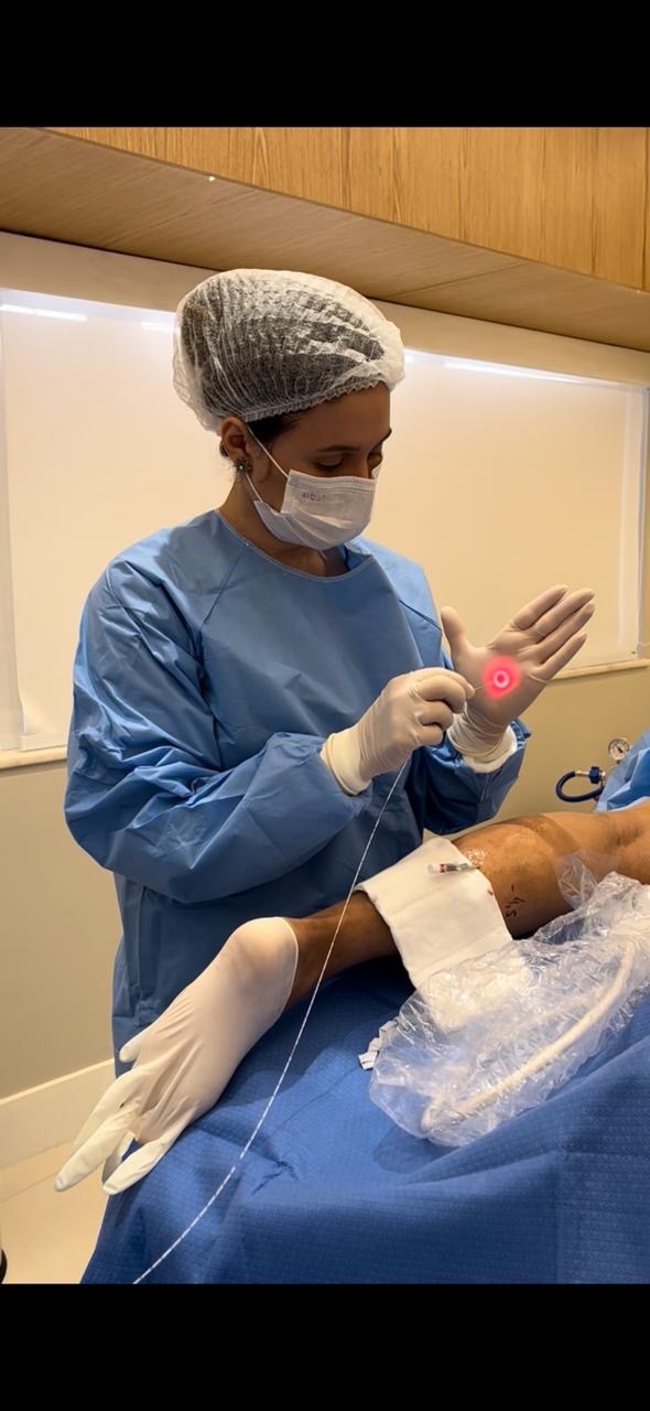 Laser de fibra óptica em procedimento vascular